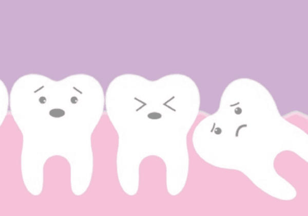 Wisdom-teeth-coloured